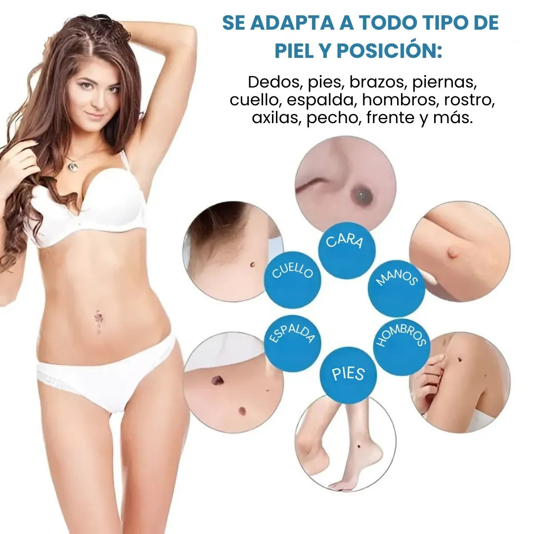DERMOFIX® KIT CLÍNICO PARA REMOVER VERRUGAS