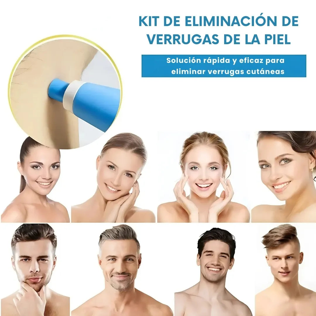 DERMOFIX® KIT CLÍNICO PARA REMOVER VERRUGAS