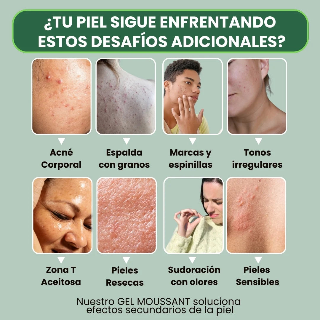GEL MOUSANT SVR® DESODORANTE DE DUCHA, HIDRATA, REJUVENECE Y ELIMINA EL SUDOR